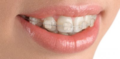 orthodontiste lyon